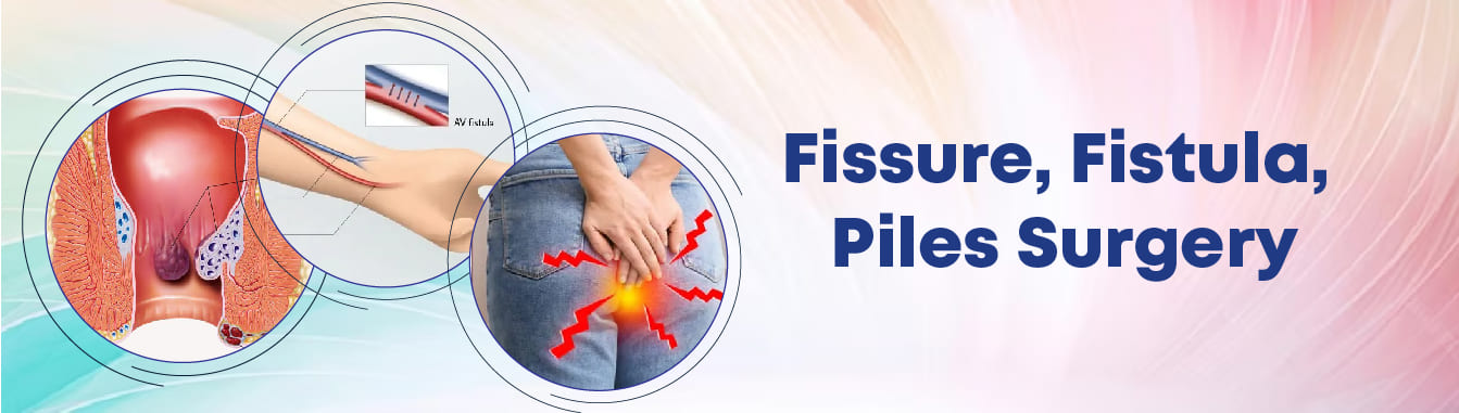 Fissure, Fistula, Piles Surgery